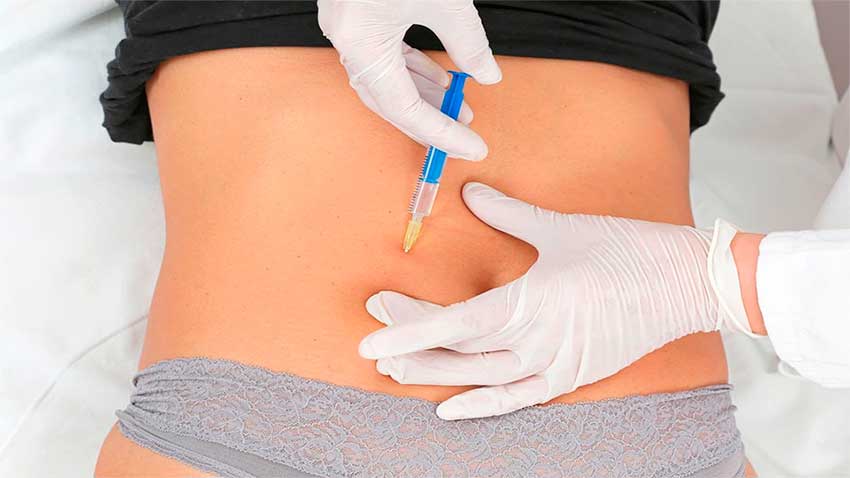 abdomen-reduccion-de-medidas-con-carboxiterapia