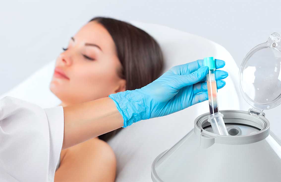 plasma-rico-en-plaquetas-life-skin-lima-peru