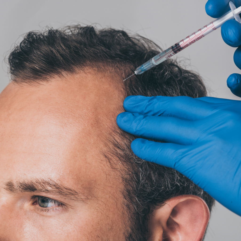 El tratamiento con Plasma Rico en Plaquetas es una novedosa técnica que permite aislar y utilizar los factores de crecimiento presentes en la sangre del propio paciente para potenciar, acelerar y estimular la regeneración de los tejidos.